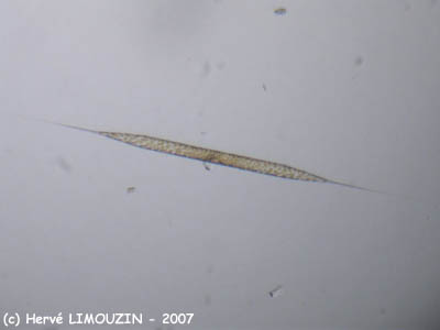 diatomee_rhizosolenia_sp_5571